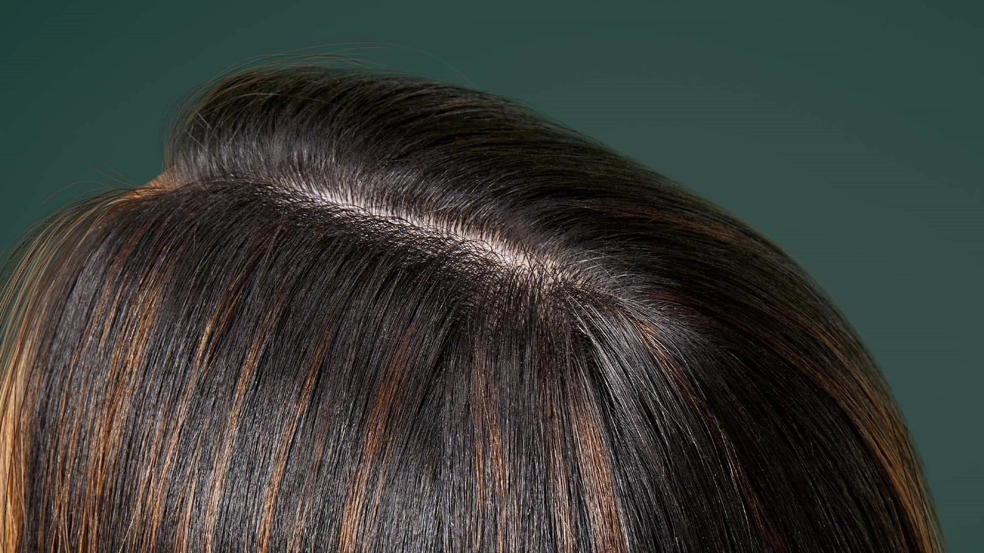 Vitamins for hair growth: what actually works for when your hair is shedding? cover